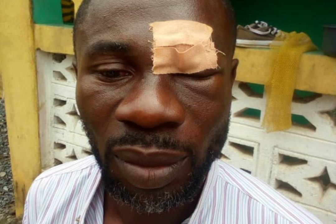 W/R: Essiama – Commercial Driver Conveying Sick SHS Student To Hospital Brutalized